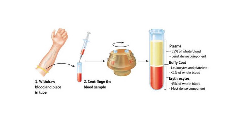 PRP-BEHANDLUNG