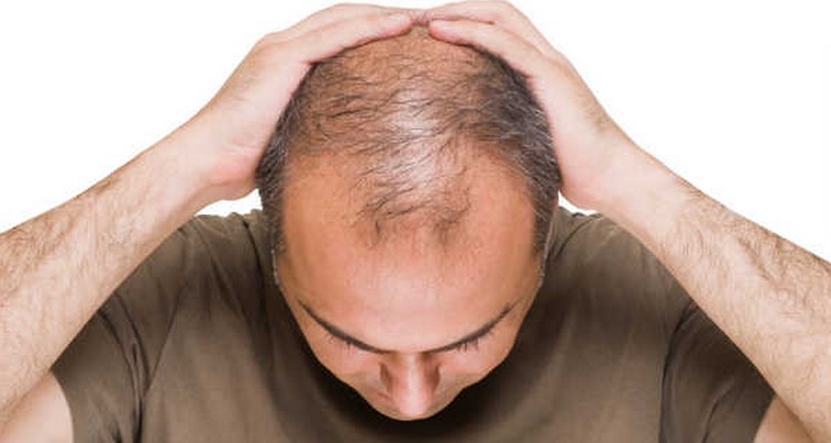 Stressbedingter Haarausfall
